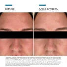 SkinCeuticals Clear Daily Soothing UV Defense Sunscreen SPF 50